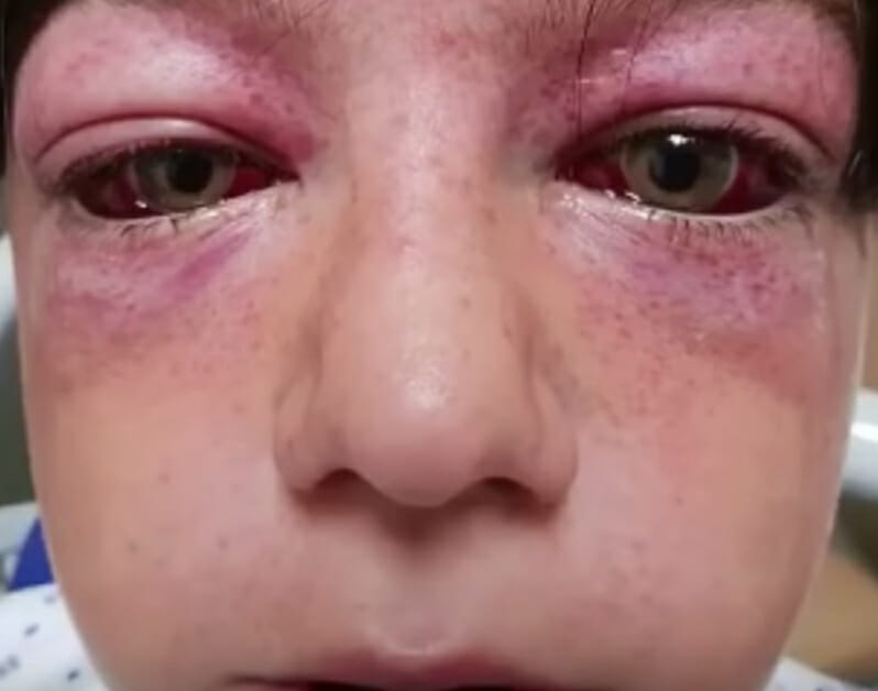 After her child’s face is nearly disfigured by a playground stunt, she wants to warn other parents.