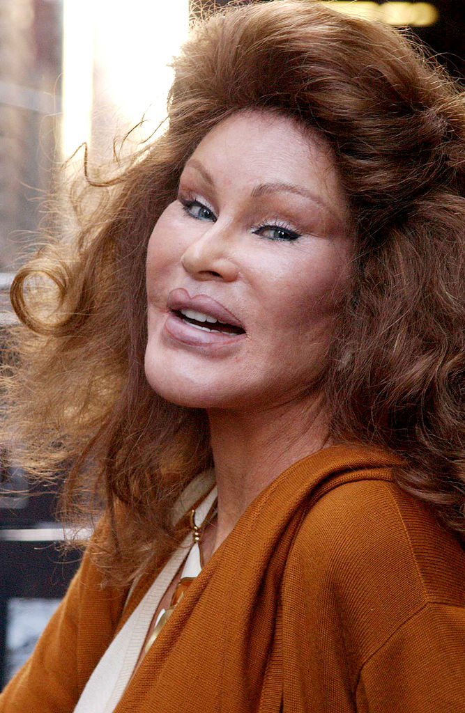 The life of „Catwoman” Jocelyn Wildenstein