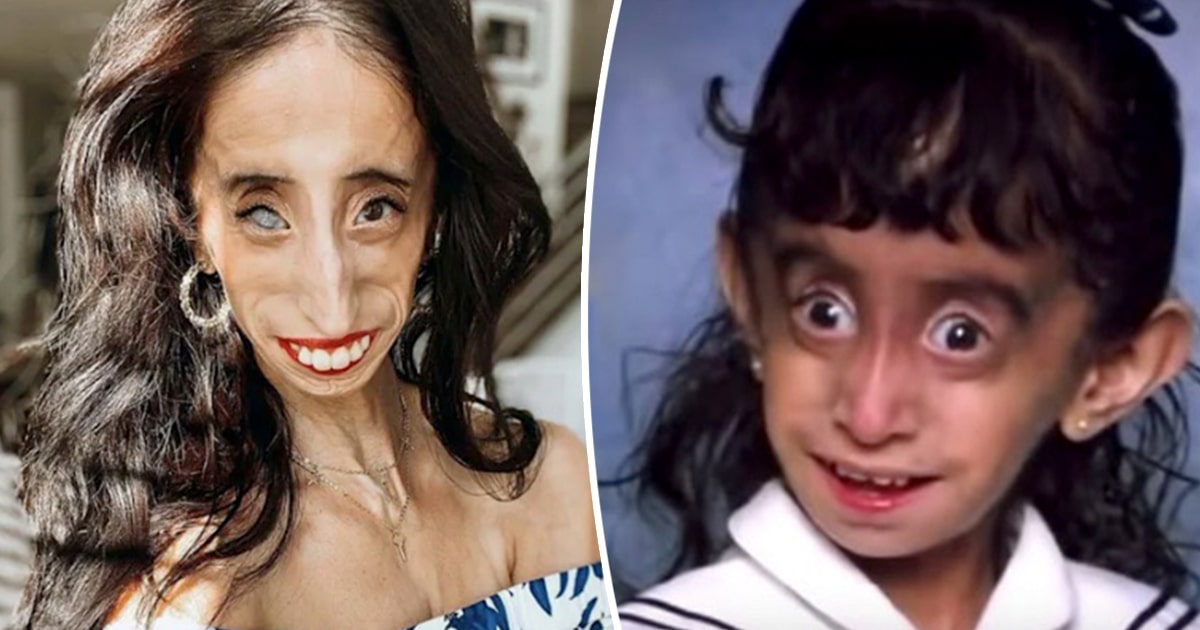 This is Lizzie Velásquez in 2022