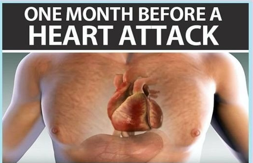 Your body will warn you one month before a heart attack. The following are the six symptoms: