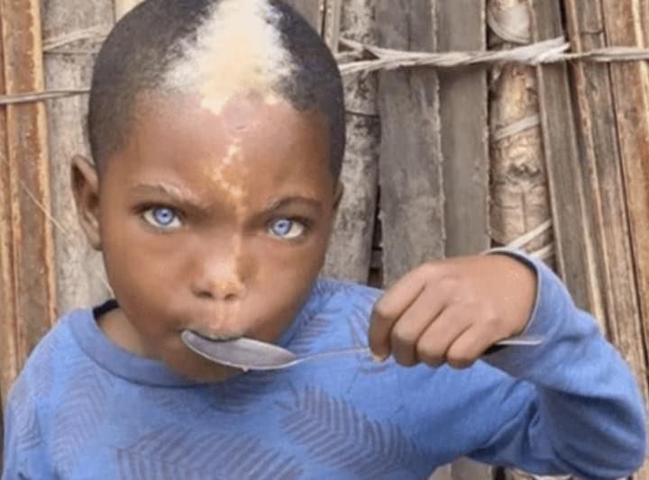 A video of a little boy with natural blue eyes, white hair, and a lightning mark on his face has gone viral.