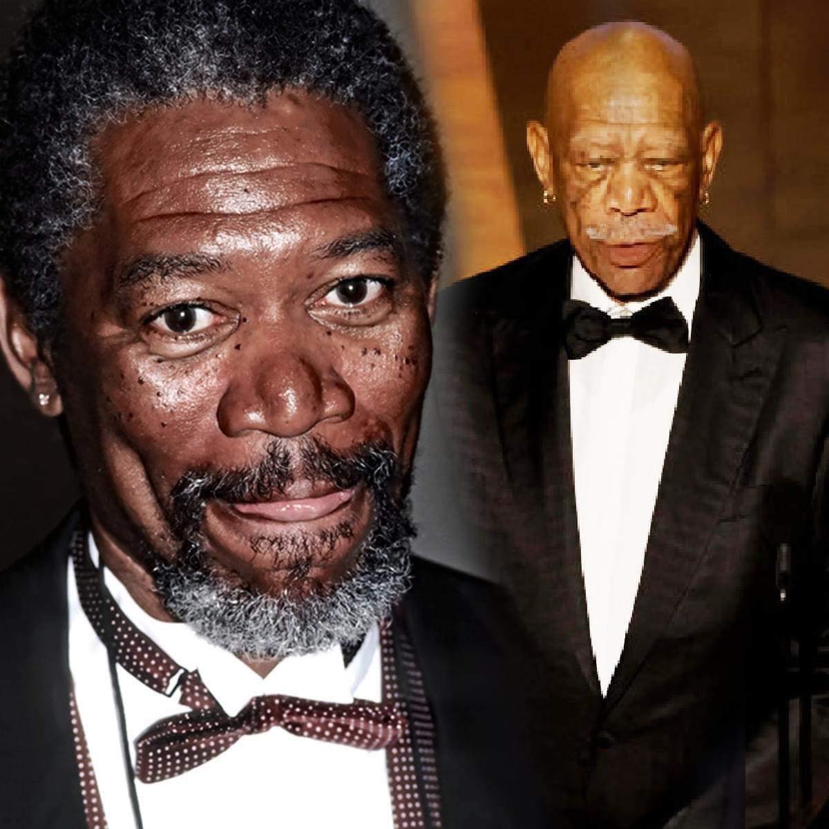 Morgan Freeman is fighting fibromyalgia, an unseen disease that causes paralysing aches