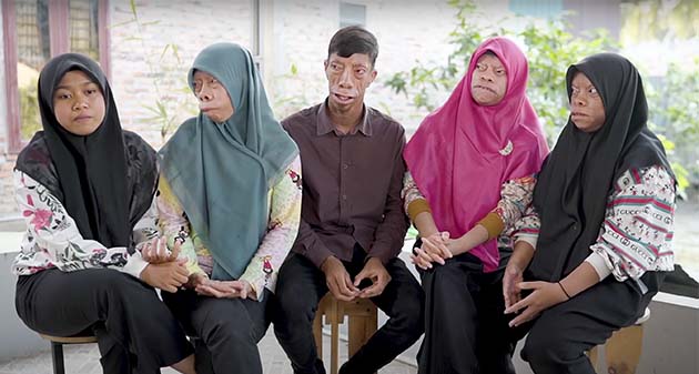 Family with mysterious facial condition are becoming an internet sensation – now they’re inspiring millions worldwide