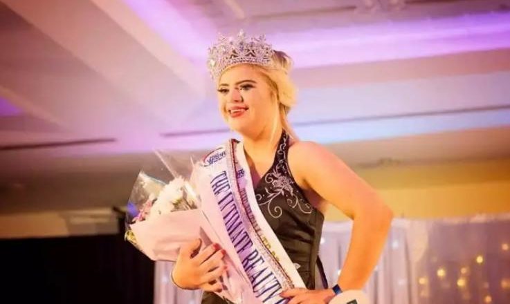 The Down syndrome girl won the beauty contest: She didn’t believe she was special.