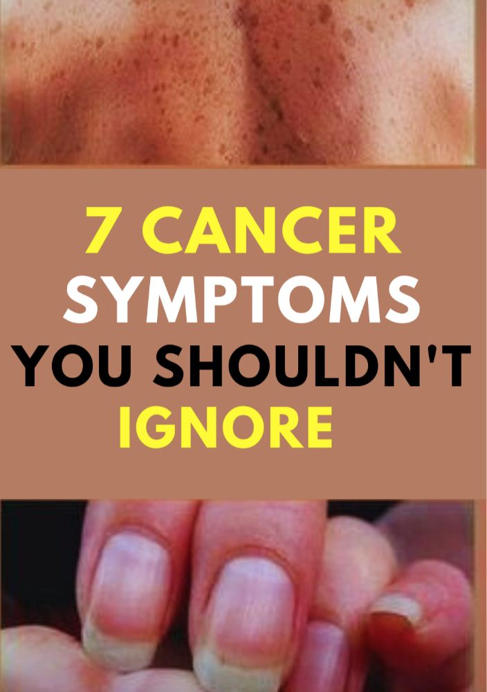 7 Cancer Disease Symptoms You Shouldn’t Ignore