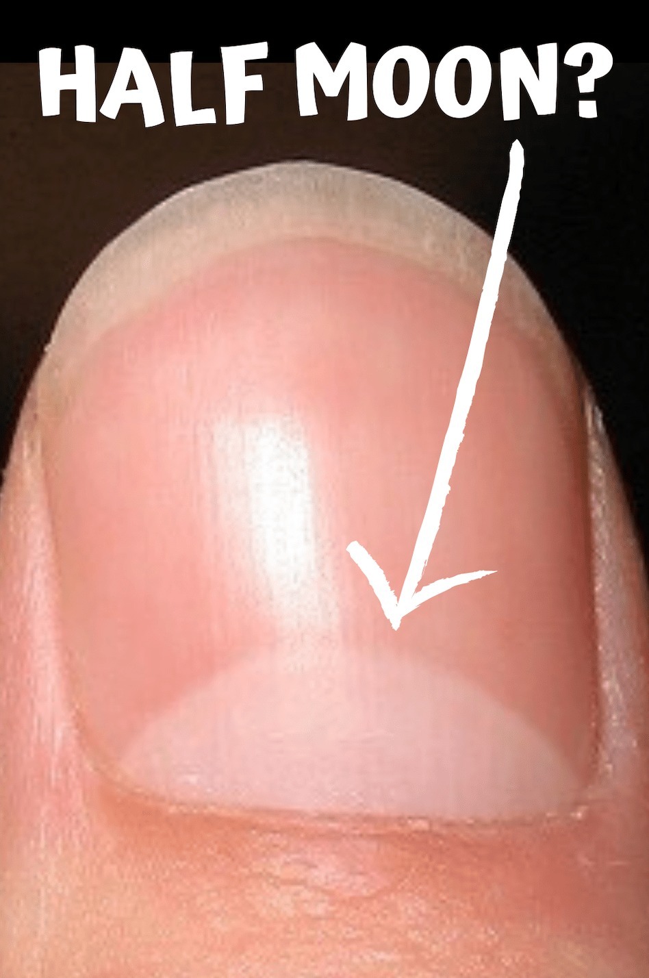 Your fingernails are alerting you to the following: Inflammation, organ failure, or even worse