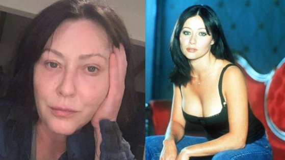 Shannen Doherty reveals brain cancer