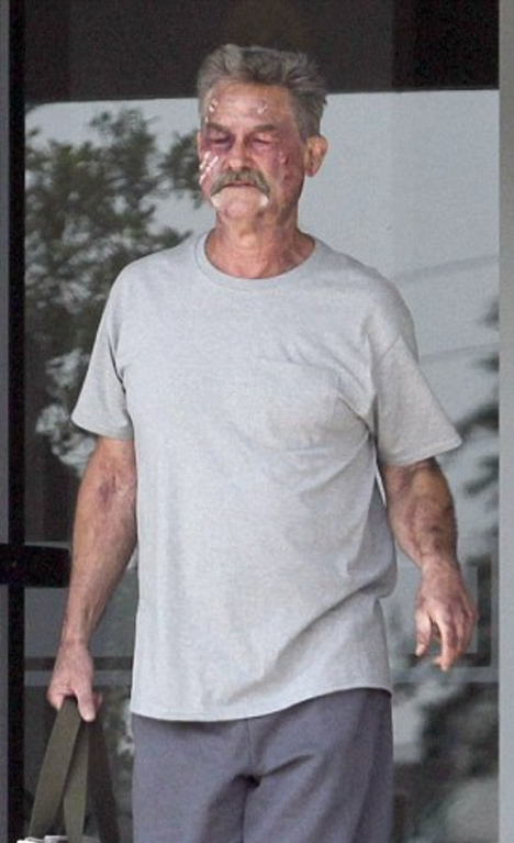 Kurt Russell had what medical conditions? 