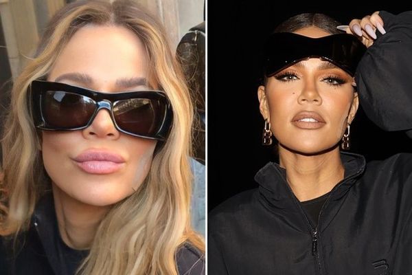 Why Khloe Kardashian is Wearing a Bandage on Her Face