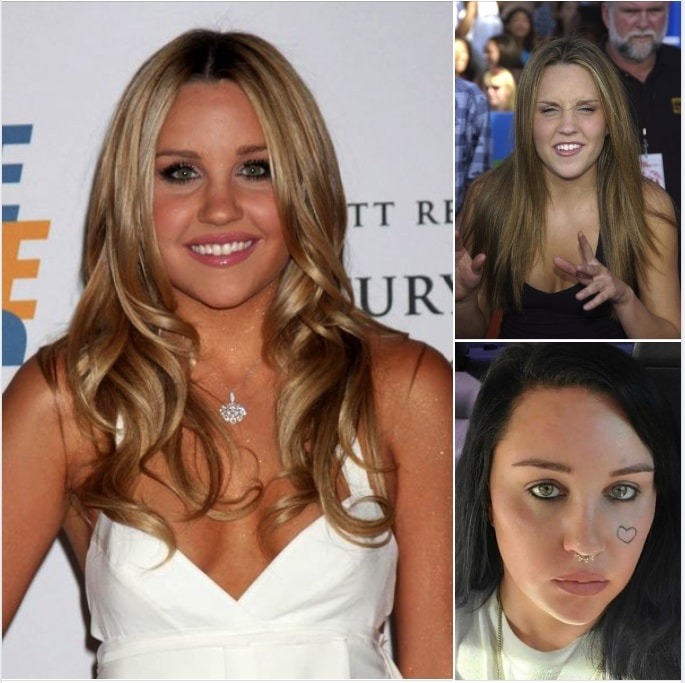 Amanda Bynes: Embracing a Journey of Recovery