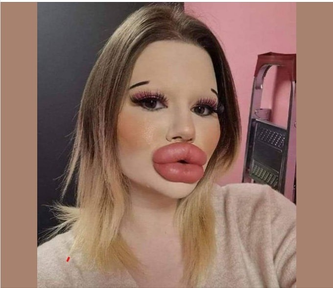 Chasing the Dream: The Woman with the Biggest Lips in the World