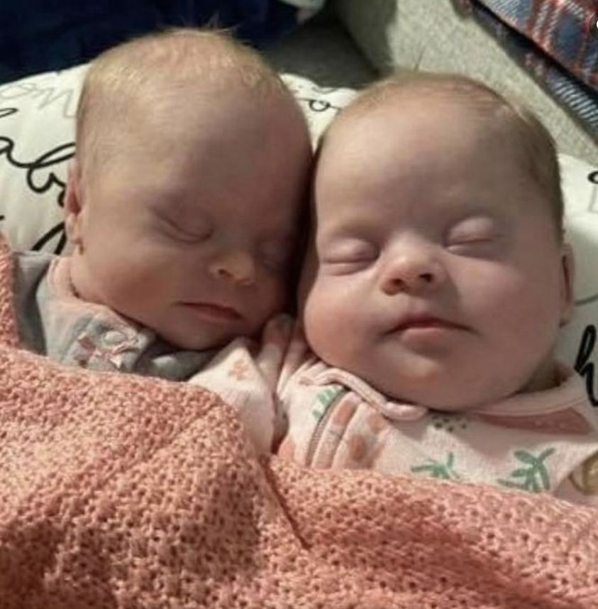 A Heartwarming Story of Rare and Precious Twins with Down Syndrome