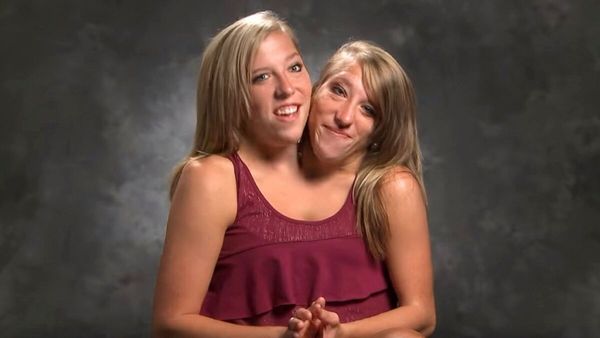 Abby and Brittany Hensel: The Incredible Lives of Conjoined Twins