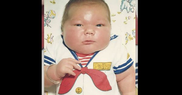 The Incredible Story of a 16-Pound Giant Baby