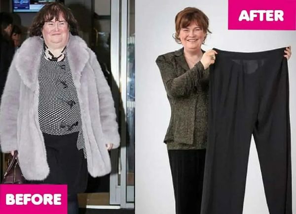 Susan Boyle before and after weight loss