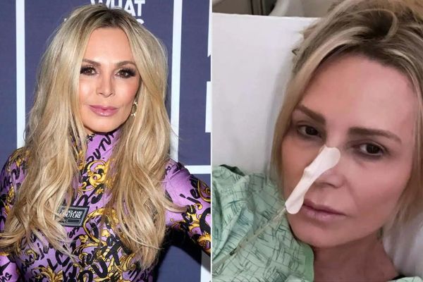 Tamra Judge: Wishing Her a Speedy Recovery