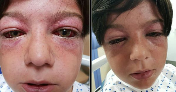 Playground Craze Puts 11-Year-Old Boy’s Life at Risk – A Warning for Parents