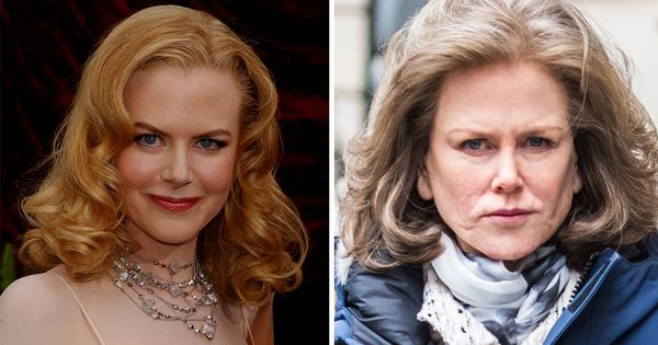 Nicole Kidman Opens Up About Health Issues Caused by Her Height