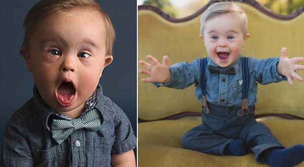 Boy with Down syndrome rejected for clothing advertisement