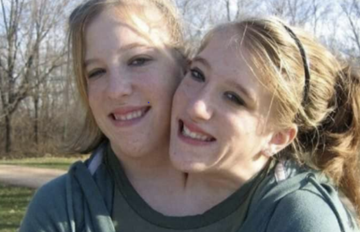 Abby and Brittany, the Incredible Conjoined Twins, Share a Heartwarming Wedding Bond